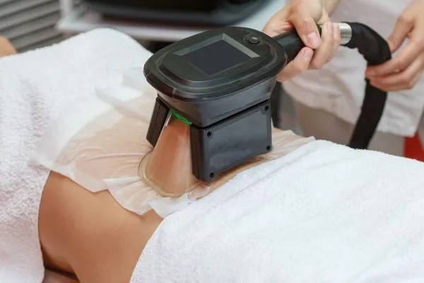 Image of person having fat freezing treatment to help weight gain Wincanton