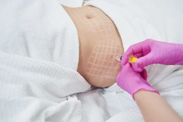 image of fat dissolving injections on love handles to help combat weight gain Wincanton