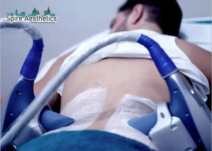 Man having fat freezing treatment done on love handles before a competitions Wincanton to create a sculpted look.