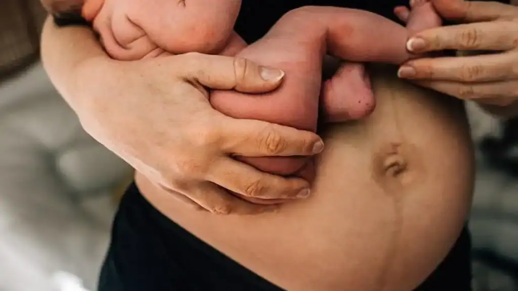 Why Is My Stomach Still Big After Pregnancy Wincanton?
